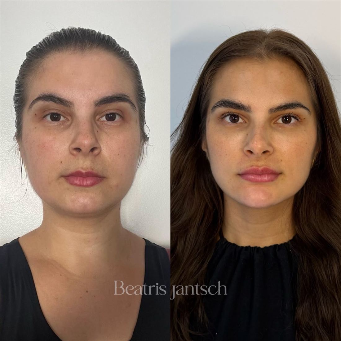 Antes e depois — caso 8